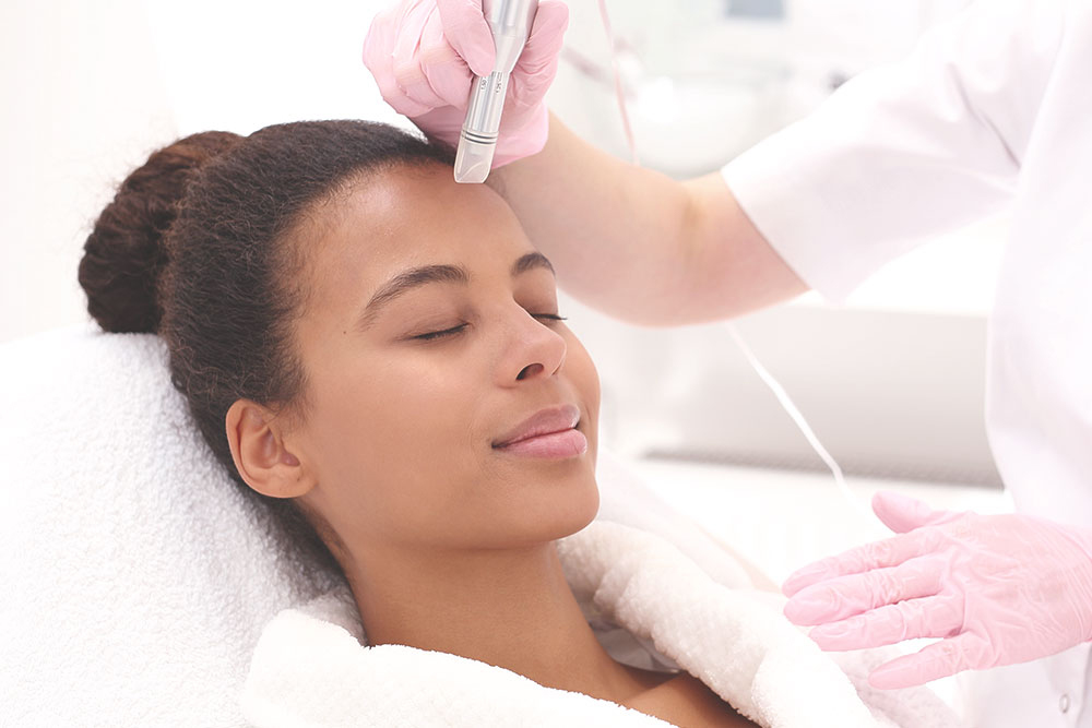 Microneedling with Secret™ RF Microneedling in New York