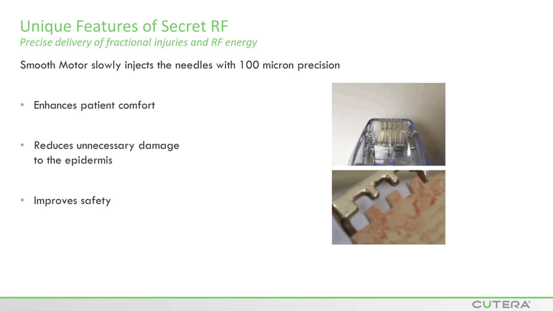 MICRO-NEEDLING SECRET™ RF