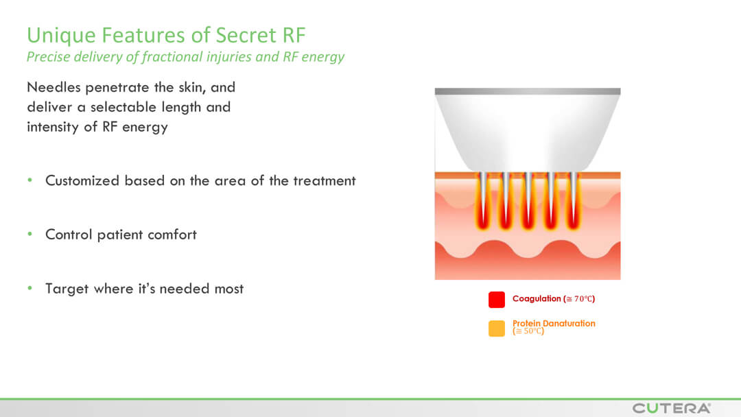 MICRO-NEEDLING SECRET™ RF