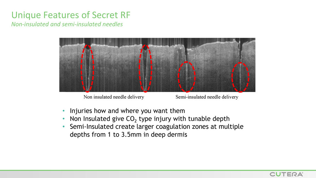 MICRO-NEEDLING SECRET™ RF