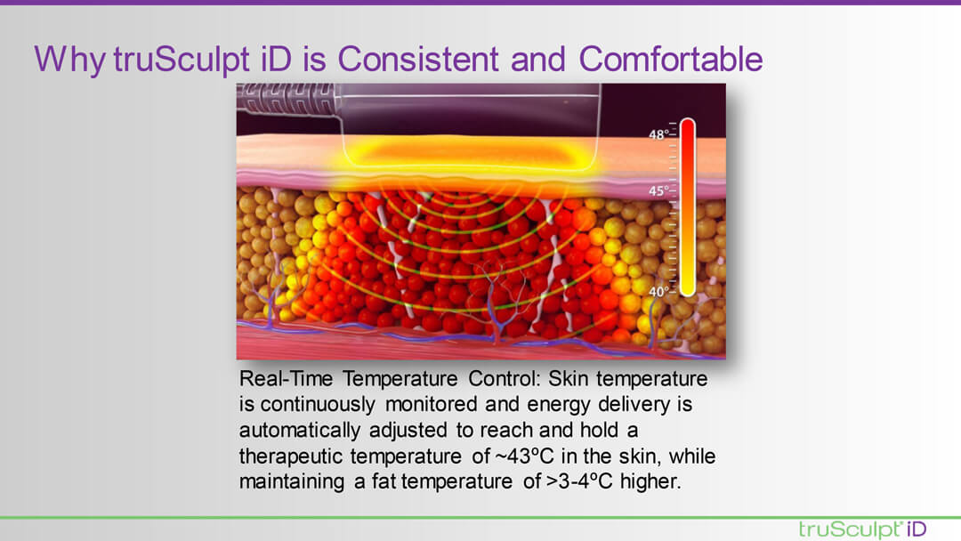 TRUSCULPT® ID Sales Presentation