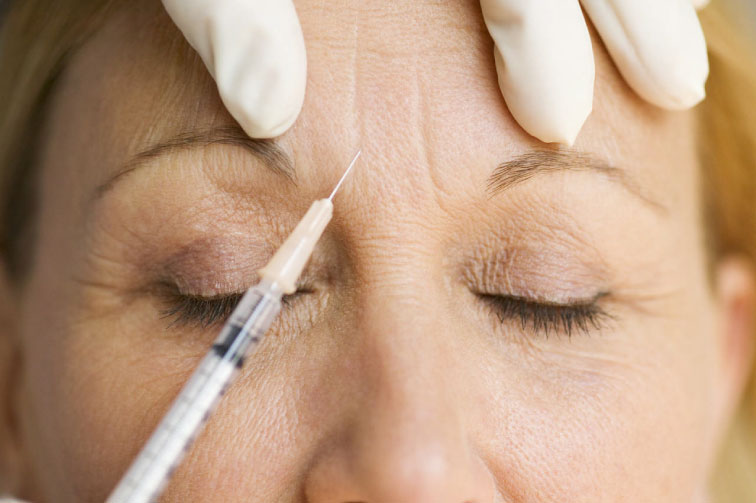 Botox Treatment