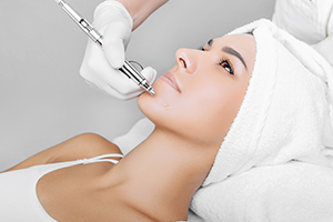 Are Chemical Peels better than others?